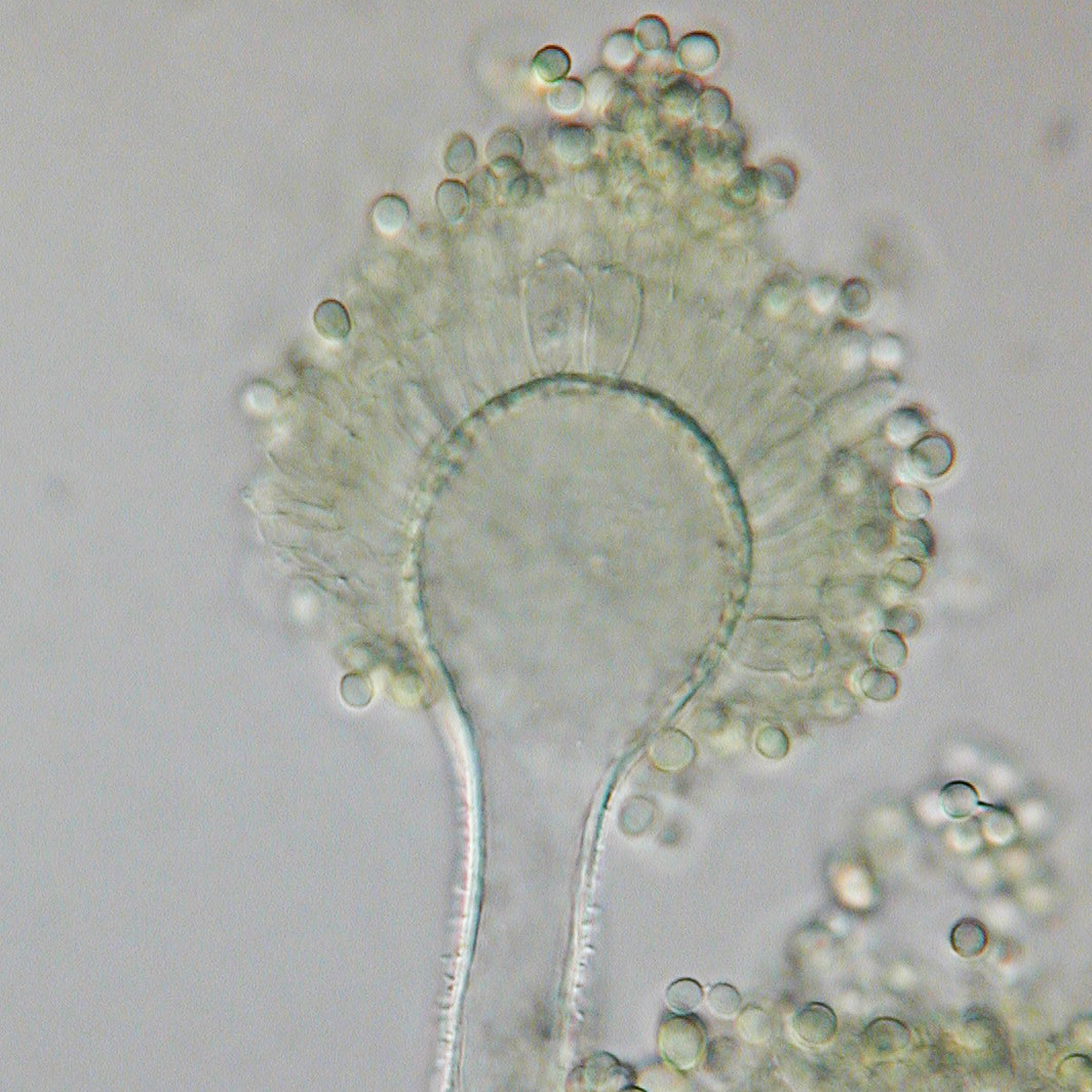Konidiofor des Schimmelpilzes Aspergillus flavus unter dem Mikroskop, Verursacher von Aflatoxinen bei schlechter Trocknung
