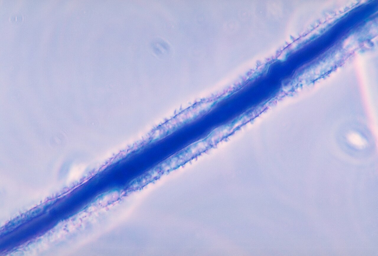 Schimmel Aspergillus flavus — Produzent von Aflatoxinen, eine zentrale Gefahr bei Nüssen